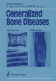 Generalized Bone Diseases (eBook, PDF)