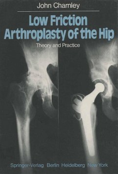 Low Friction Arthroplasty of the Hip (eBook, PDF) - Charnley, J.