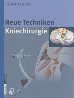 Neue Techniken Kniechirurgie (eBook, PDF) - Pässler, H. H.