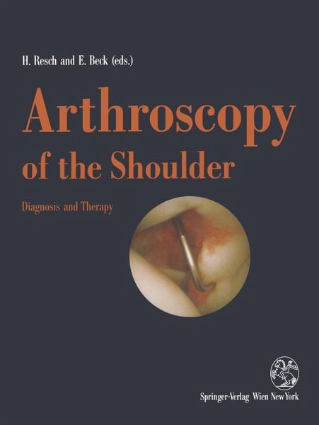 Arthroscopy of the Shoulder (eBook, PDF) Arthroscopy of the Shoulder (eBook, PDF)