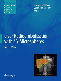 Liver Radioembolization with 90Y Microspheres (eBook, PDF)