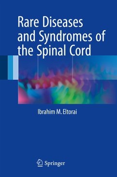 Rare Diseases and Syndromes of the Spinal Cord (eBook, PDF) - Eltorai, Ibrahim M.
