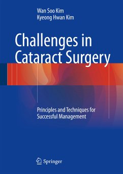 Challenges in Cataract Surgery (eBook, PDF) - Kim, Wan Soo; Kim, Kyeong Hwan