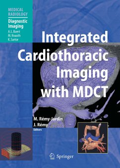 Integrated Cardiothoracic Imaging with MDCT (eBook, PDF)