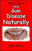 What I did to Heal Gum Disease Naturally (eBook, ePUB)