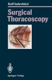 Surgical Thoracoscopy (eBook, PDF)