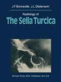 Radiology of The Sella Turcica (eBook, PDF)