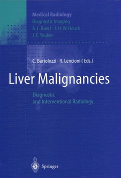 Liver Malignancies (eBook, PDF)
