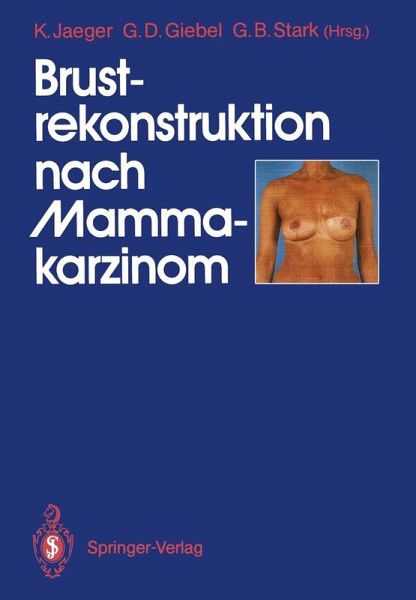 Brustrekonstruktion nach Mammakarzinom (eBook, PDF) Brustrekonstruktion nach Mammakarzinom (eBook, PDF)