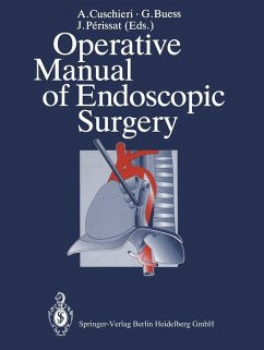 Operative Manual of Endoscopic Surgery (eBook, PDF)