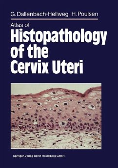 Atlas of Histopathology of the Cervix Uteri (eBook, PDF) - Dallenbach-Hellweg, Gisela; Knebel Doeberitz, Magnus von; Trunk-Gemacher, Marcus J.