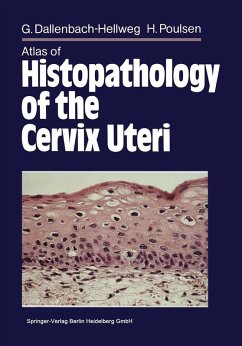 Atlas of Histopathology of the Cervix Uteri (eBook, PDF) - Dallenbach-Hellweg, Gisela; Knebel Doeberitz, Magnus von; Trunk-Gemacher, Marcus J. Atlas of Histopathology of the Cervix Uteri (eBook, PDF) - Dallenbach-Hellweg, Gisela; Knebel Doeberitz, Magnus von; Trunk-Gemacher, Marcus J.