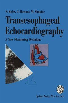 Transesophageal Echocardiography (eBook, PDF) - Kolev, Nikolai; Huemer, Günter; Zimpfer, Michael