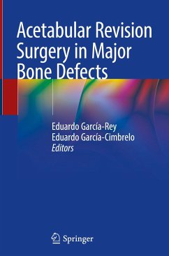 Acetabular Revision Surgery in Major Bone Defects