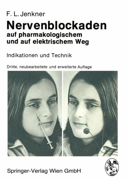 Nervenblockaden auf pharmakologischem und auf elektrischem Weg (eBook, PDF)