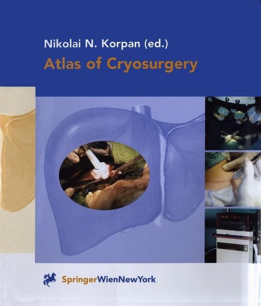 Atlas of Cryosurgery (eBook, PDF) Atlas of Cryosurgery (eBook, PDF)