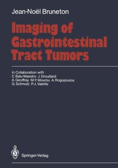 Cover Imaging of Gastrointestinal Tract Tumors (eBook, PDF)