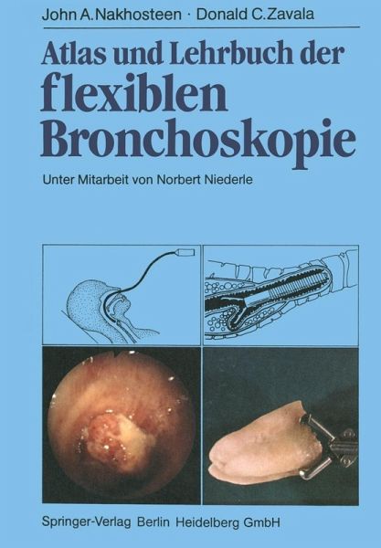 Atlas und Lehrbuch der Bronchoskopie (eBook, PDF) Atlas und Lehrbuch der Bronchoskopie (eBook, PDF)
