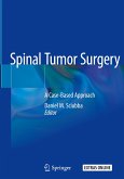 Spinal Tumor Surgery