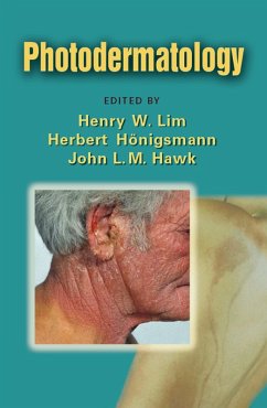 Cover Photodermatology (eBook, PDF)