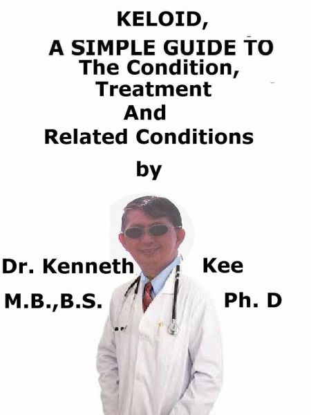 Keloid, A Simple Guide to The Condition, Treatment And Related Conditions (eBook, ePUB)