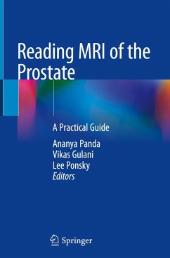 Reading MRI of the Prostate