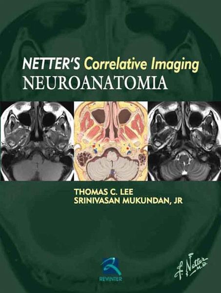 Neuroanatomia (eBook, ePUB) Neuroanatomia (eBook, ePUB)