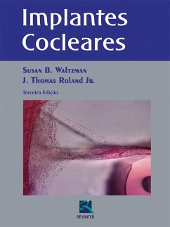 Implantes cocleares (eBook, ePUB) - Waltzman, Susan B.; Roland Jr., J. Thomas