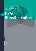 Tiefe Hirnstimulation (eBook, PDF)
