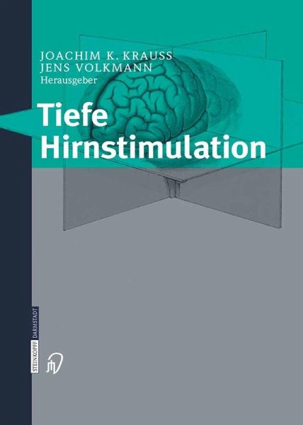 Tiefe Hirnstimulation (eBook, PDF) Tiefe Hirnstimulation (eBook, PDF)