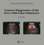 Tumour Diagnostics of the Liver with Echo Enhancers (eBook, PDF)