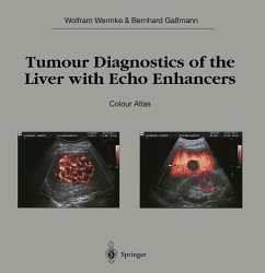 Tumour Diagnostics of the Liver with Echo Enhancers (eBook, PDF) - Wermke, Wolfram; Gaßmann, Bernhard