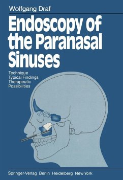 Endoscopy of the Paranasal Sinuses (eBook, PDF) - Draf, Wolfgang