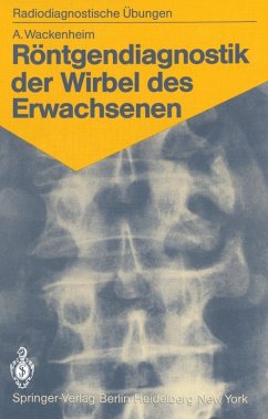 Röntgendiagnostik der Wirbel des Erwachsenen (eBook, PDF) - Wackenheim, Auguste