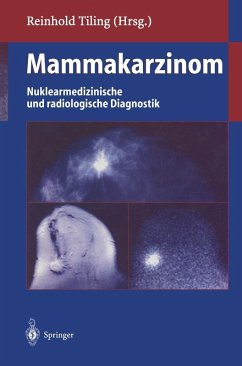 Cover Mammakarzinom (eBook, PDF)