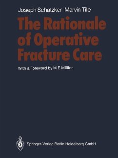 The Rationale of Operative Fracture Care (eBook, PDF) - Schatzker, Joseph; Tile, Marvin