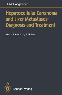 Cover Hepatocellular Carcinoma and Liver Metastases: Diagnosis and Treatment (eBook, PDF)