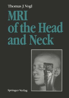 MRI of the Head and Neck (eBook, PDF) - Vogl, Thomas J.
