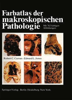 Cover Farbatlas der makroskopischen Pathologie (eBook, PDF)