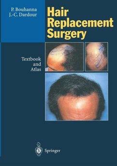 Hair Replacement Surgery (eBook, PDF) - Bouhanna, Pierre; Dardour, Jean-Claude