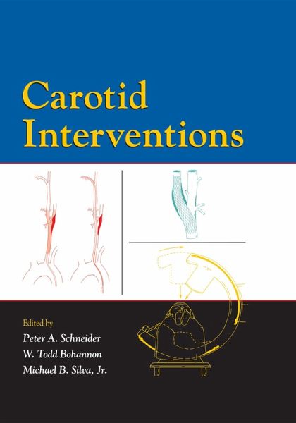 Carotid Interventions (eBook, PDF)