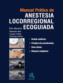 Cover Manual prático de anestesia locorregional ecoguiada (eBook, ePUB)
