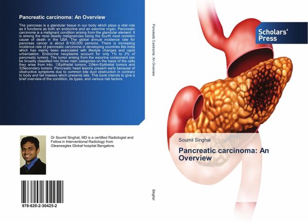 Pancreatic carcinoma: An Overview Pancreatic carcinoma: An Overview