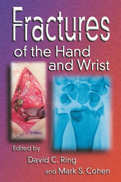 Cover Fractures of the Hand and Wrist (eBook, PDF)