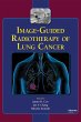 Image-Guided Radiotherapy of Lung... - Bild 1