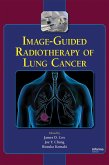 Image-Guided Radiotherapy of Lung Cancer (eBook, PDF)