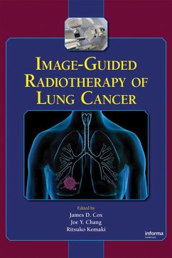 Image-Guided Radiotherapy of Lung Cancer (eBook, PDF)