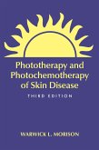Phototherapy and Photochemotherapy for Skin Disease (eBook, PDF)