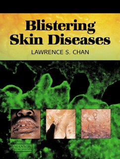 Cover Blistering Skin Diseases (eBook, PDF)