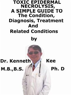 Toxic Epidermal Necrolysis, A Simple Guide To The Condition, Diagnosis, Treatment And Related Conditions (eBook, ePUB) - Kee, Kenneth
